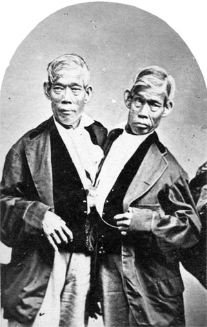 Chang and Eng | Tacky Harper's Cryptic Clues Chang and Eng | Tacky Harper's Cryptic Clues